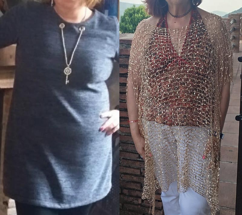 Caso real antes y después