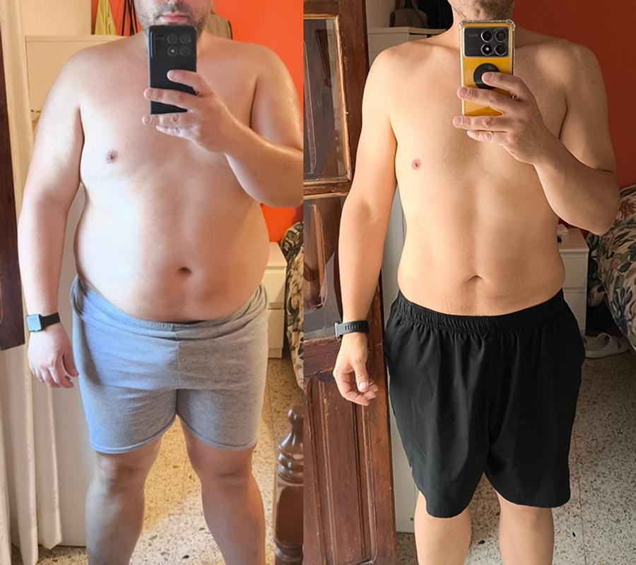 Caso real antes y después