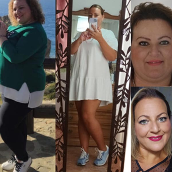 Caso real antes y después