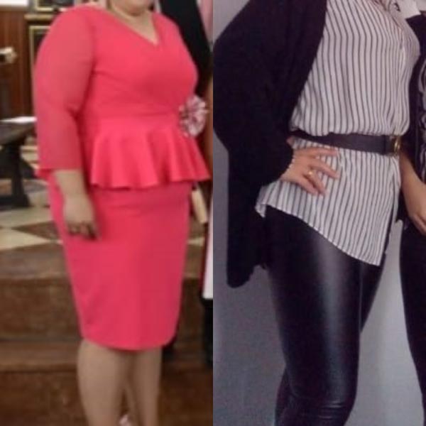 Caso real antes y después