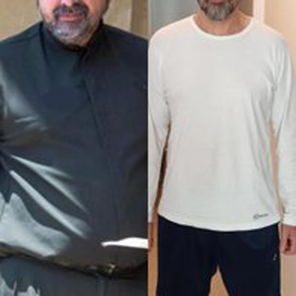 Caso real antes y después